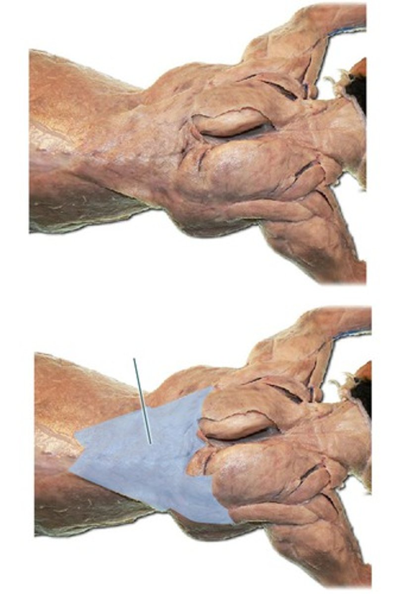 <p>name this muscle</p>