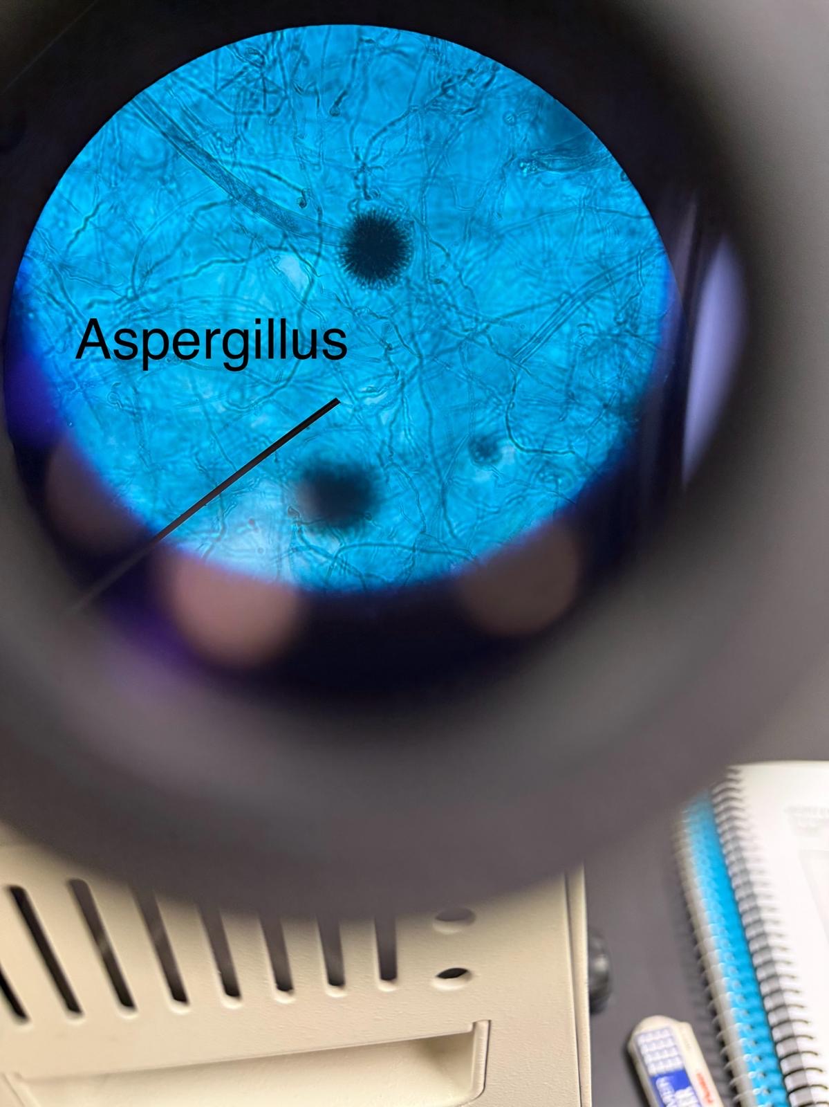 <p>aspergillus</p>