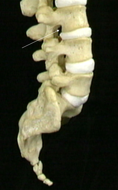 intervertebral foramen 