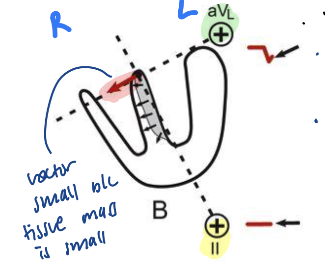 <p><strong>The Electrocardiogram</strong></p><p>What is happening here?</p>