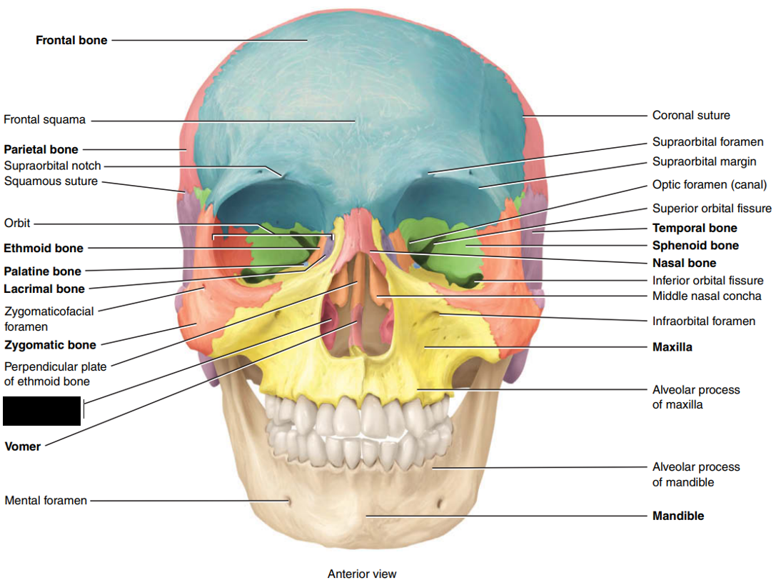 <p>State and identify which part of the cranial bone is being censored.</p>