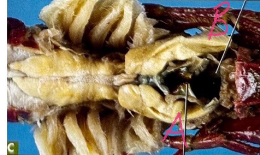 <p>B and function </p>