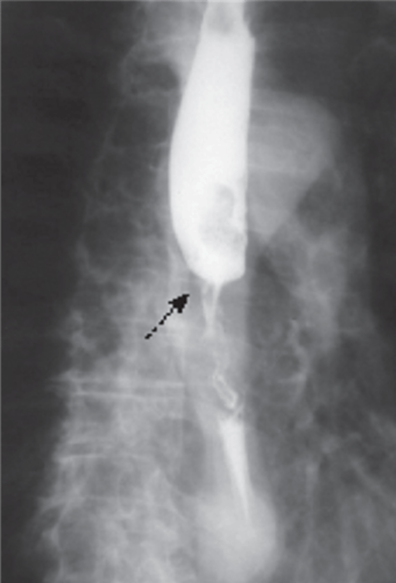 knowt flashcard image