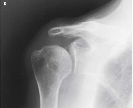 <p>What type of projection, position and anatomy is this?</p>