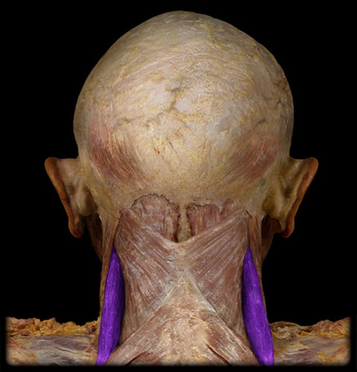 <p>elevates scapula; inferiorly rotates scapula</p>