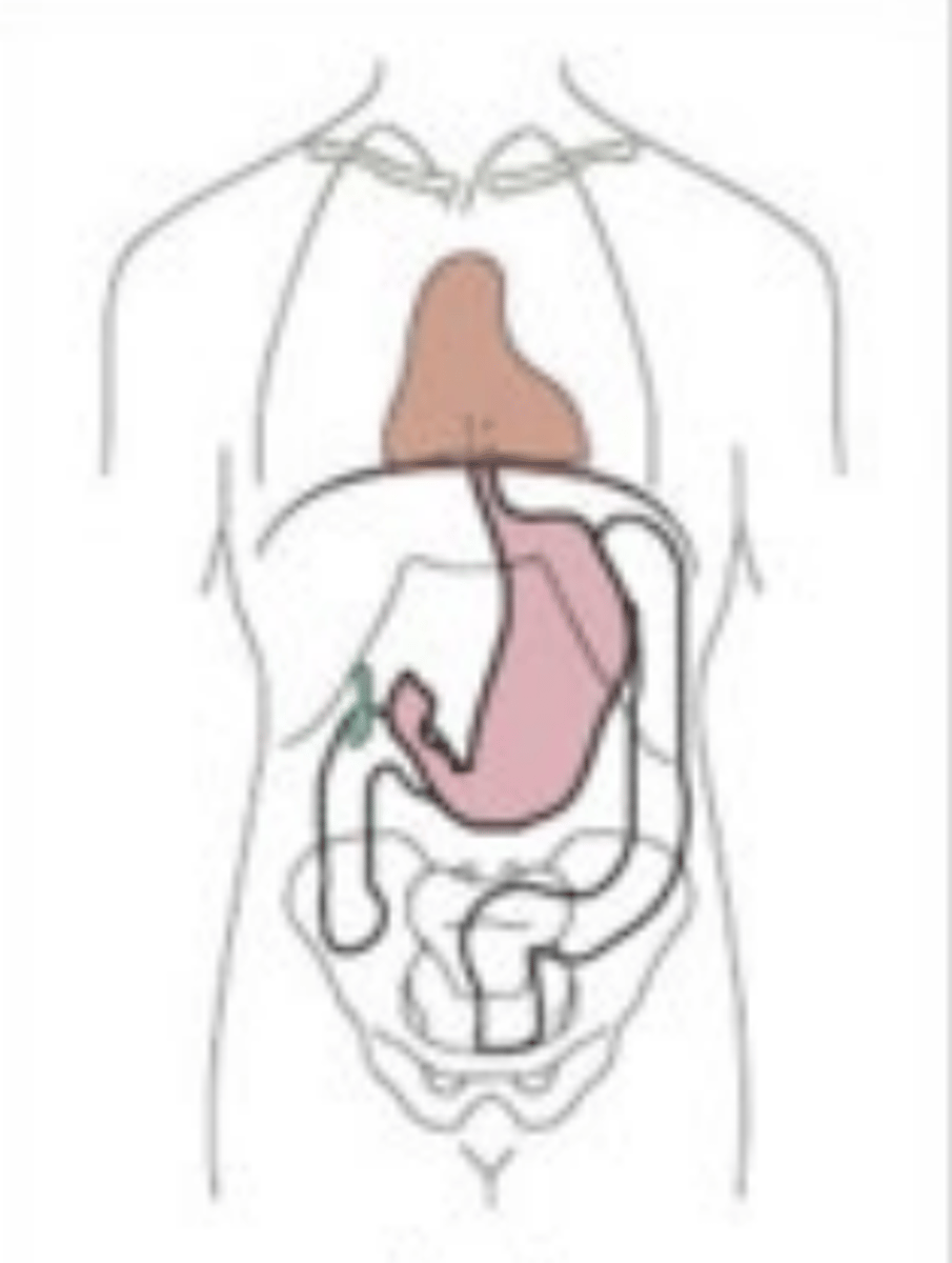 <p>Type of Body Habitus</p>
