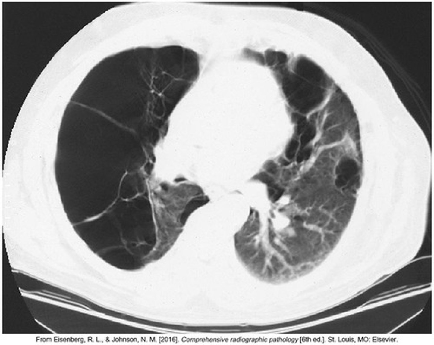 <p>Detailed imaging for assessing lung conditions.</p>