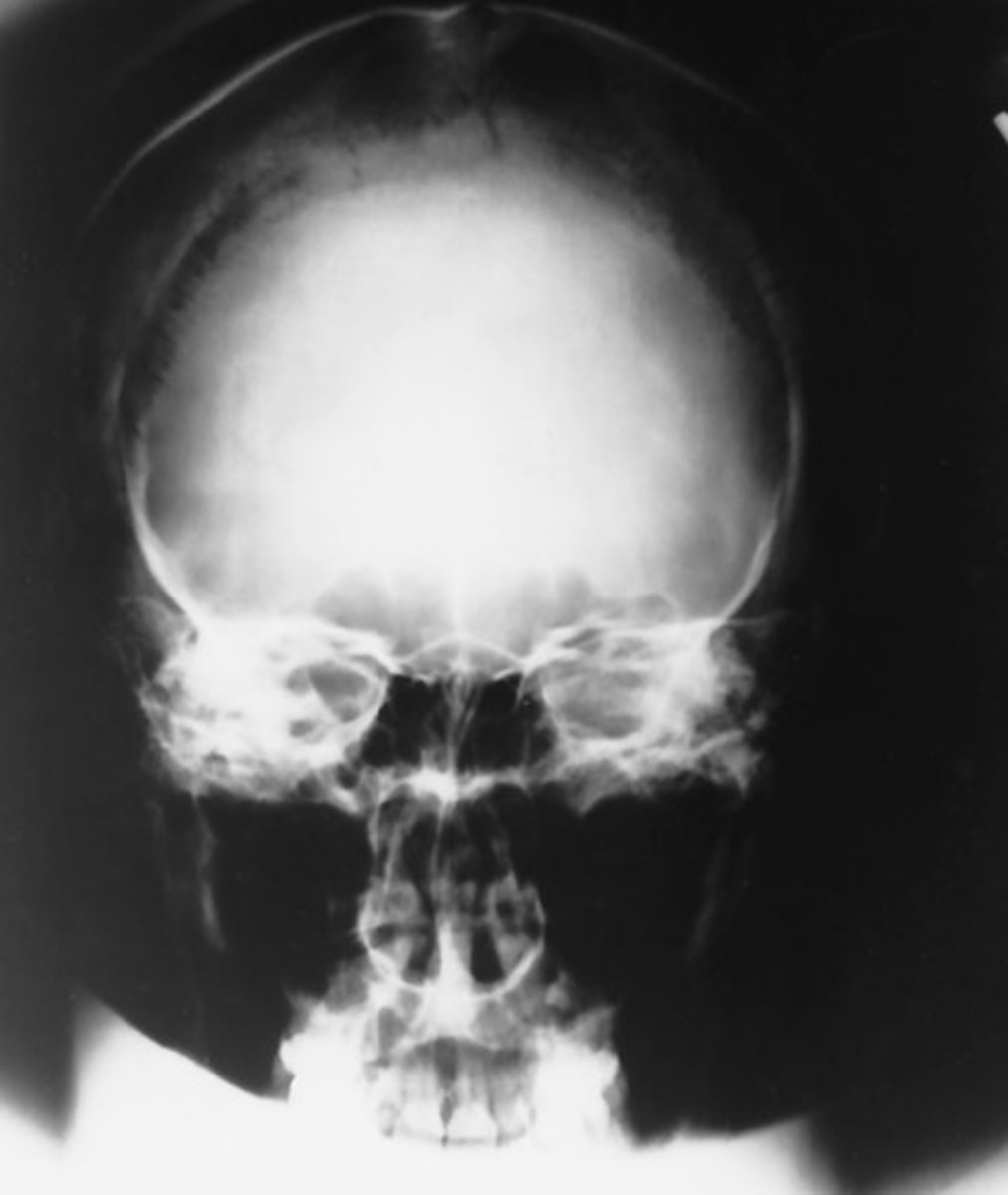 <p>Which position is this?</p>