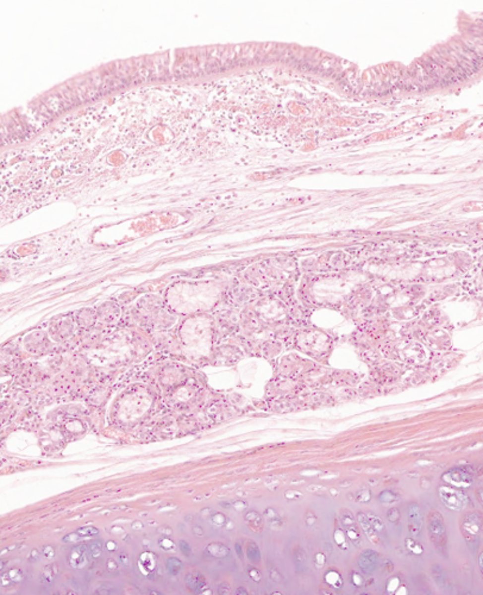 <p>where would the following histo slide be taken from?</p>