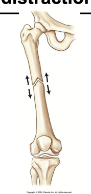 <p>What apposition is this?</p>