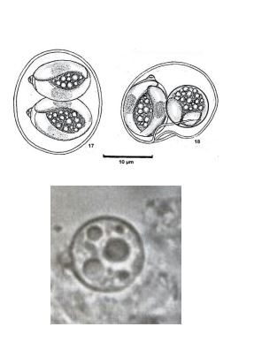 <p><em>Cyclospora cayetanensis</em></p>