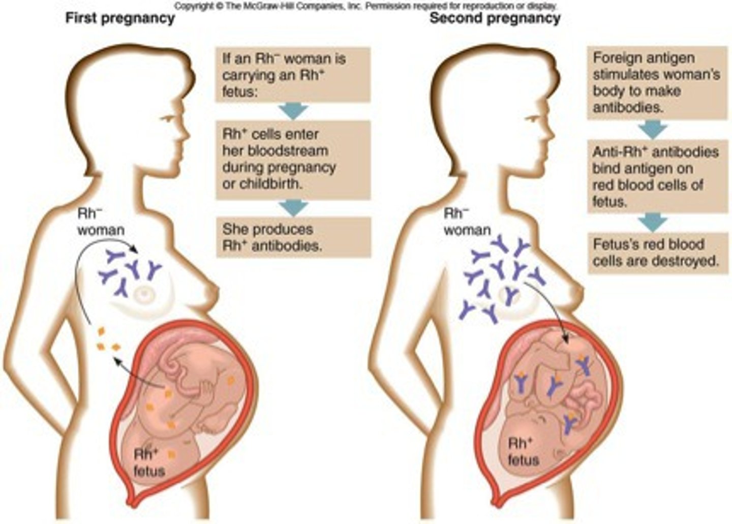 <p>rhesus incompatibility</p>