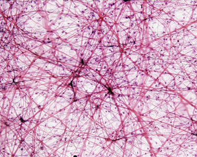<p>Connective tissue</p>