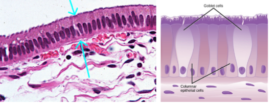 <ul><li><p>taller</p></li><li><p>simple vs. pseudostratified </p></li></ul><p></p>