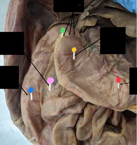 <p>What’s the pink pin </p>