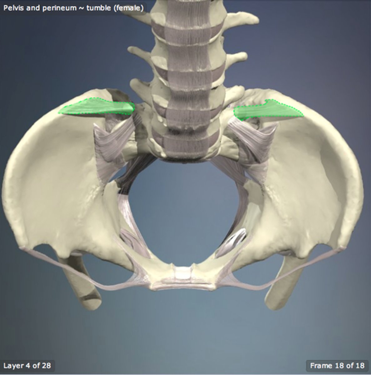 <p>connects the transverse process of L5 with ilium</p><p>*originally a muscle</p>