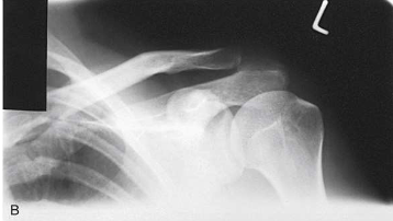 <p>What type of projection, position and anatomy is this?</p>