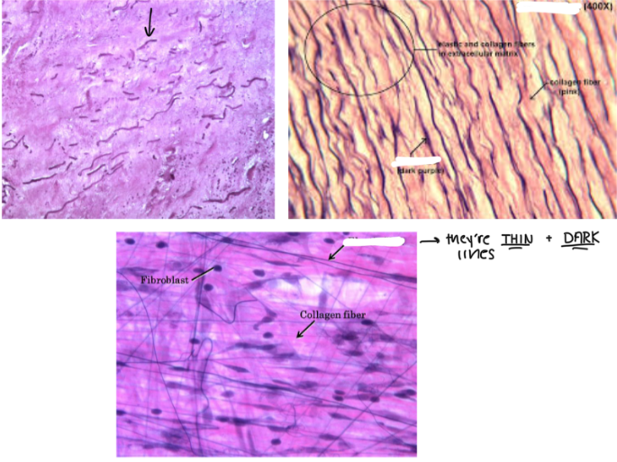 <p>These are <strong>STRETCHY FIBERS</strong> made of protein elastin which<strong> ALLOWS STRETCH AND RECOIL (like a rubber band)</strong></p><ul><li><p><strong>THIN, DARK LINES</strong> in the microscope </p></li><li><p>Kinda looks like <strong>stretch marks</strong> under the microscope </p></li><li><p>Made from elastin (a type of fiber)</p></li></ul><p></p>