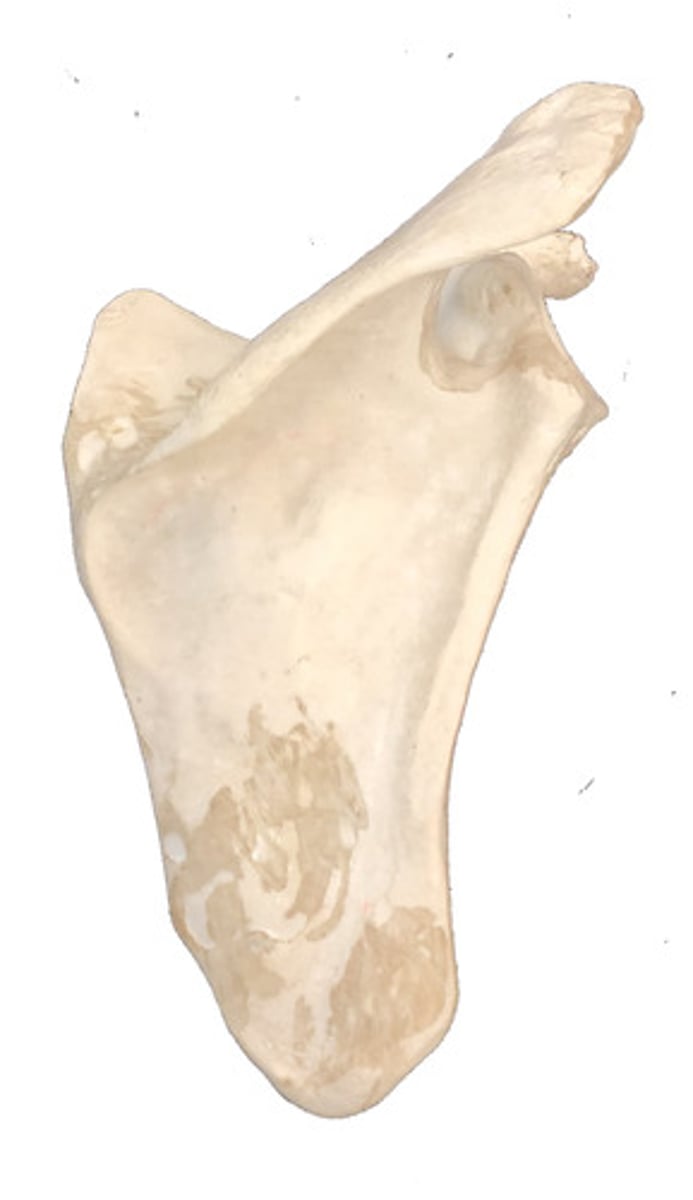 <p>Identify this bone.</p>