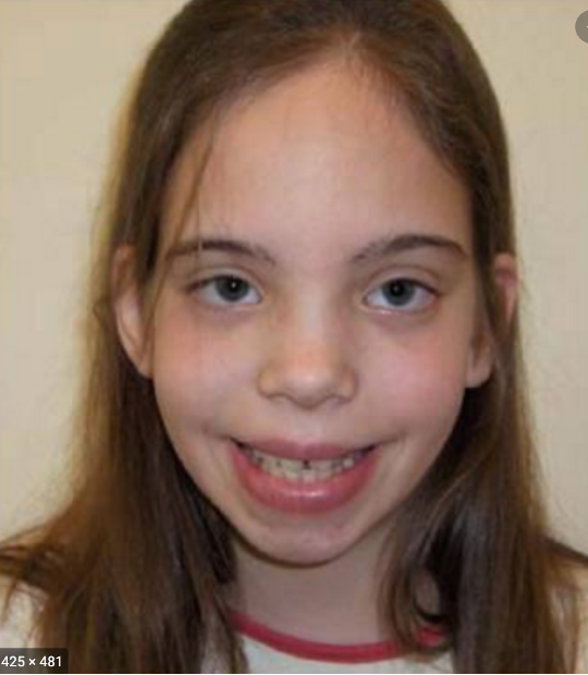 <p>The following clinical features are associated with what condition?</p><ul><li><p>Tall height &amp; relatively small head circumference</p></li><li><p>Intelligence 15-20 pts lower than siblings</p></li><li><p>1:1000 female births; most diagnoses incidentally / never</p></li></ul><p></p>
