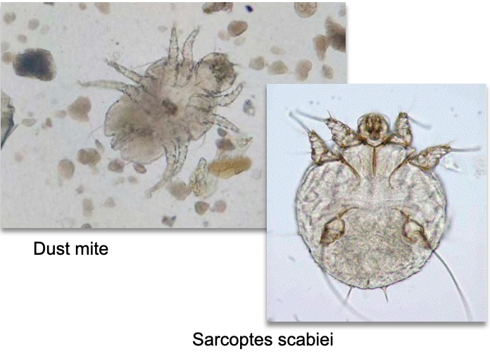 <ul><li><p class=""><strong>Type</strong>: External skin parasites (e.g., <em>Sarcoptes scabiei</em>, dust mites)</p></li><li><p class=""><strong>Entry into Urine</strong>: Contamination</p></li><li><p class=""><strong>Note</strong>: Dust mites often environmental; scabies mites may indicate true infestation</p><p class=""></p></li></ul><p></p>