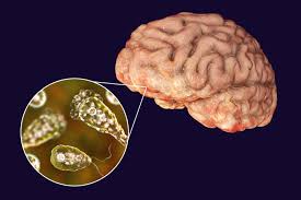 <p><span>Alzheimer’s disease</span></p>