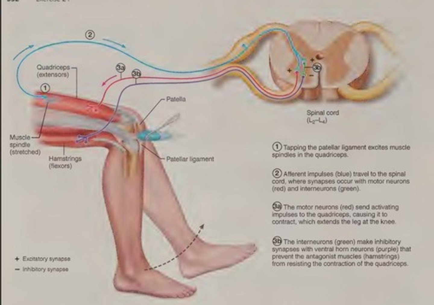 <p>A specific example of a stretch reflex assessed by tapping the patellar ligament.</p>