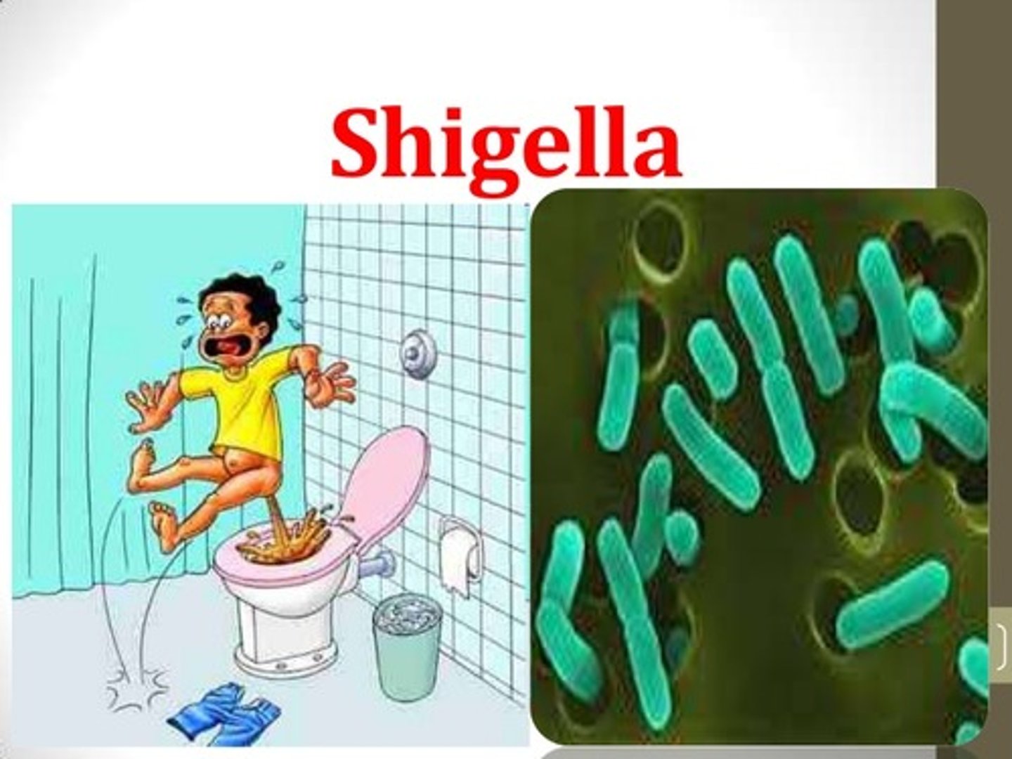 <p>Pathogen: Shigella dysenteriae</p><p>S+S: Abdominal pain, nausea, vomiting, fever, dysentery</p><p>Transmission: Fecal-oral route, ingestion of contaminated food or water</p>