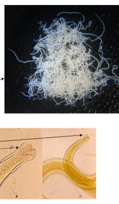 <p>What GIN is shown in this image</p><p>why</p><p>found where</p><p>symptoms of infection</p><p>ppp?</p>