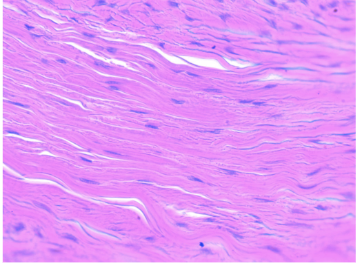 <p>Fibers run in the same direction, little matrix visible. Function is for strength, resists pulling forces, attaches structures. Found in Tendons and Ligaments</p>