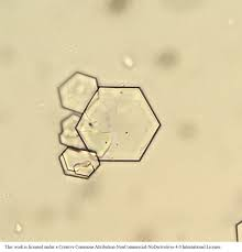 <p>appearance: hexagonal</p><p>indicate: bacterial UTI</p>