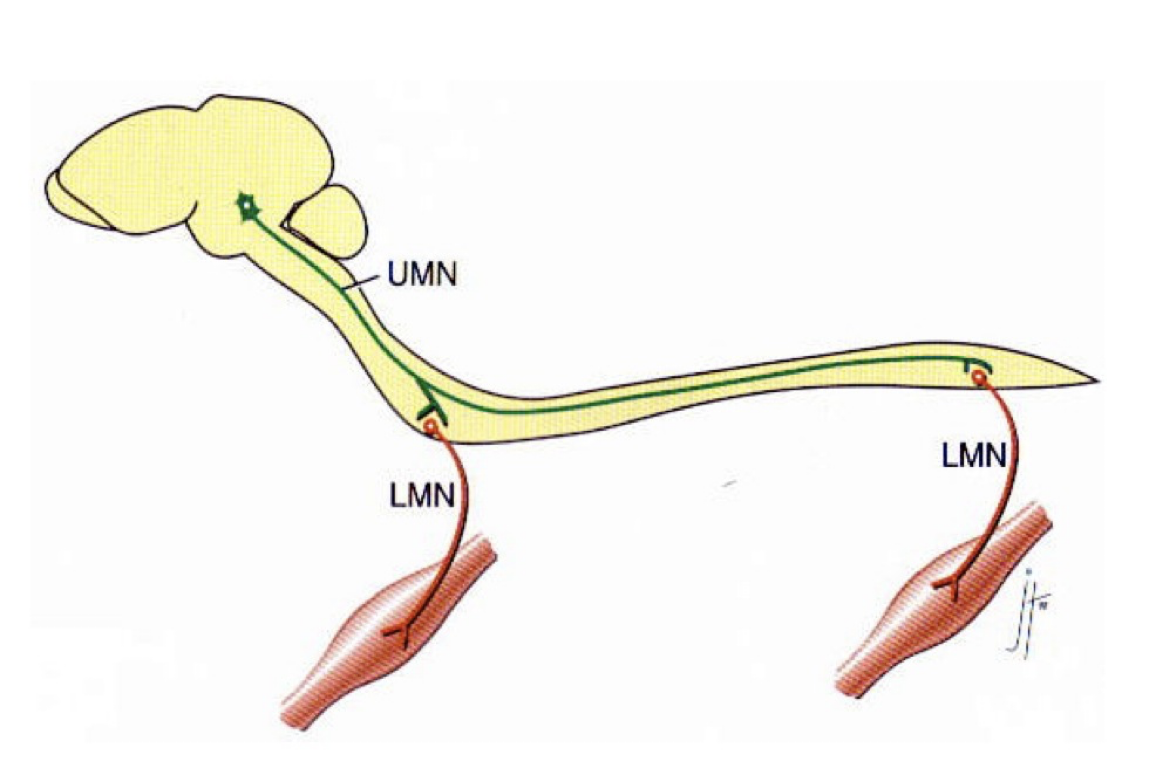 <p><strong>Lower motor neuron</strong> is simply a motor neuron that&nbsp;controls the muscle movements from everything BELOW the neck</p><p></p><p>There are <strong>upper motor neurons</strong>… these are nerves that originate in the motor region of the cerebral cortex / brainstem and stretch ALL THE WAY DOWN THE CNS</p><ul><li><p>Carry motor information DOWN to the lower motor neurons</p></li></ul><p></p><p>Prof explained it as this: the thought / desire to move your hand comes from the UPPER MN, sending the signal to your LOWER MN to actually act on the movement </p><ul><li><p>Upper neuron activated before lower neuron</p></li></ul><p></p>