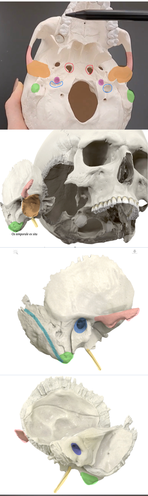 <p><span>What is the bone highlighted in blue (third photo)?</span></p>