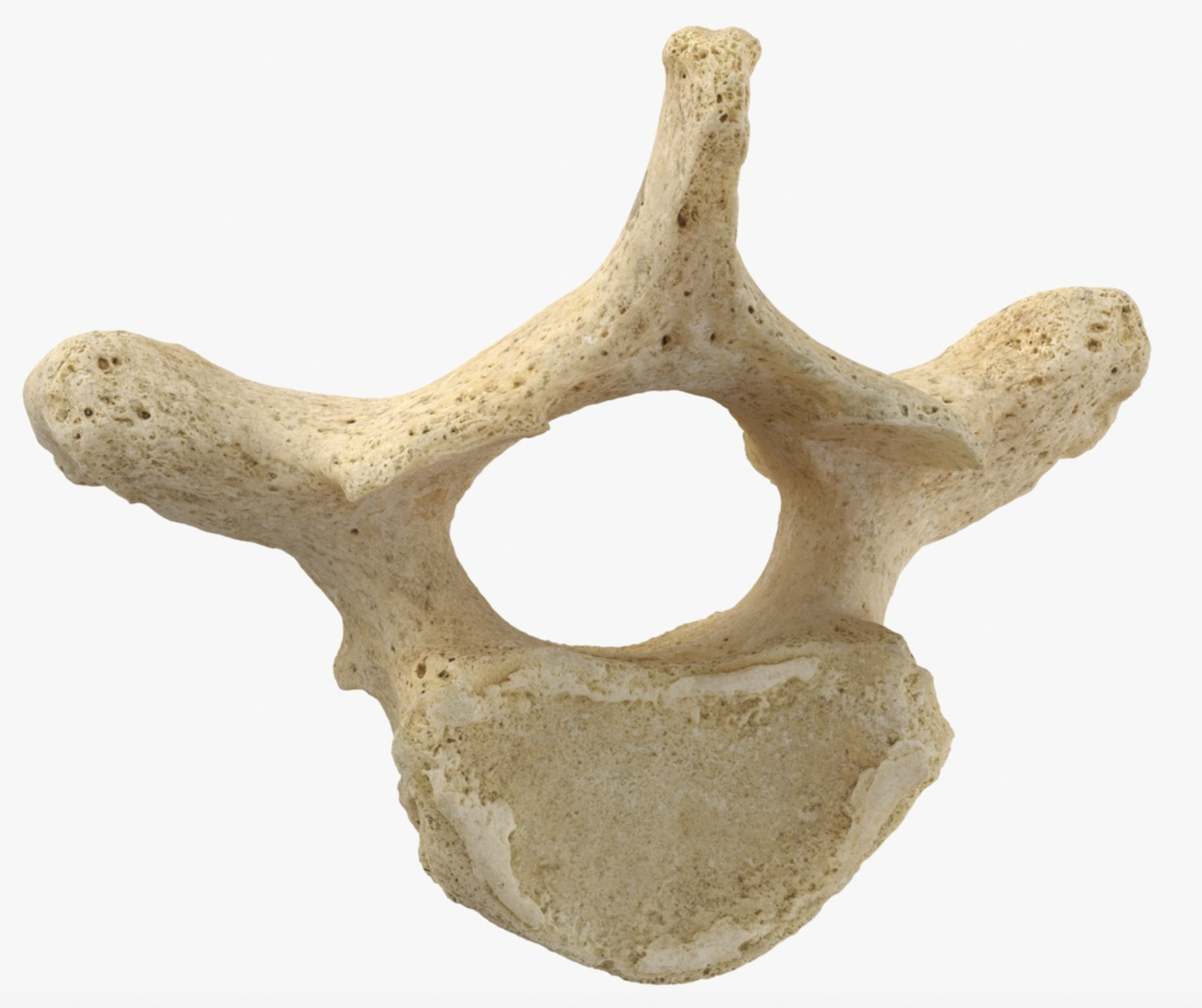 <p>What vertebra is this?</p>