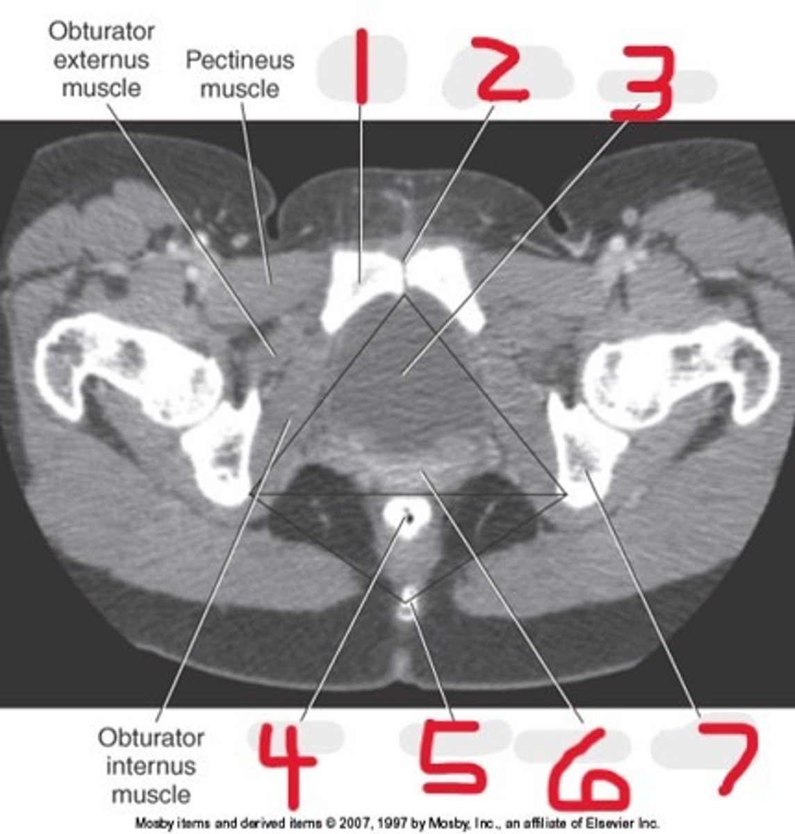 <p>Name all numbered structures</p>