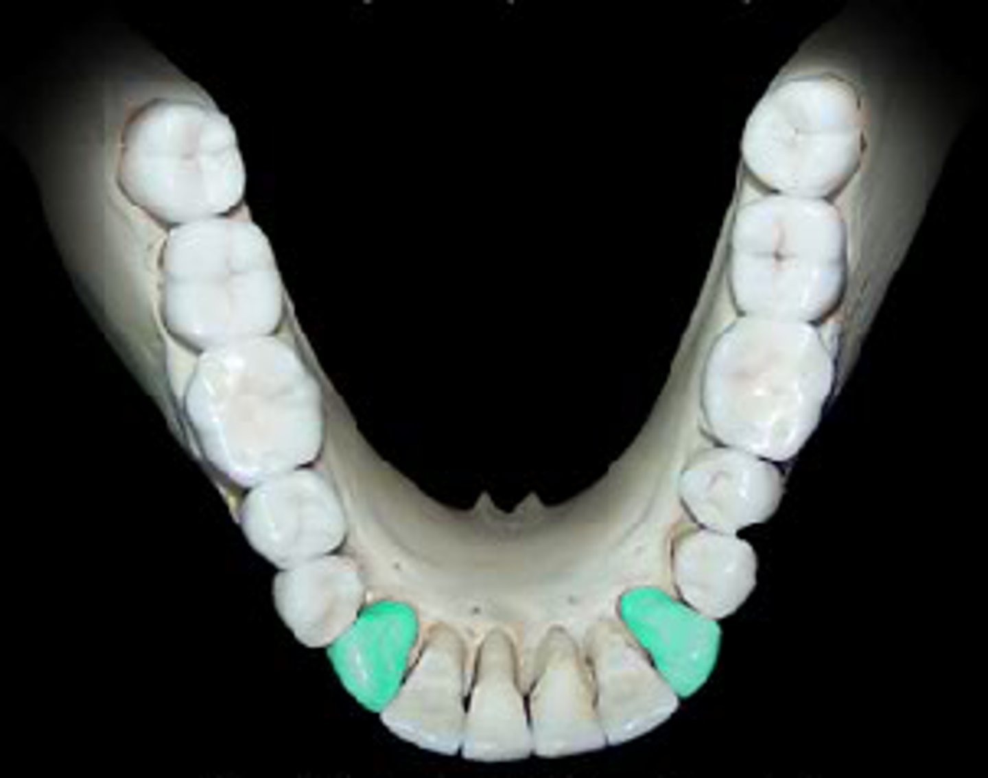 <p>Pointed teeth that tear/slash food</p>