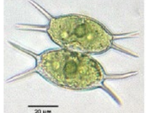 <p>(frw planktonic)</p>
