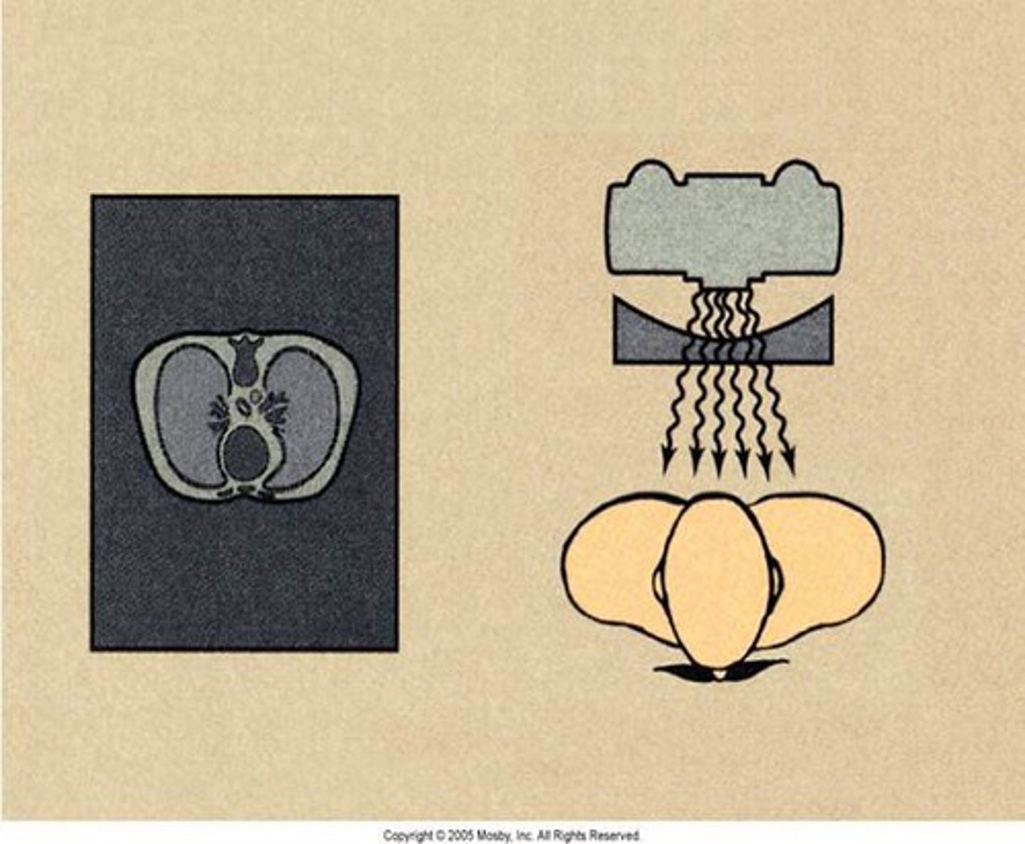 <p>-often used for the chest and thorax</p>