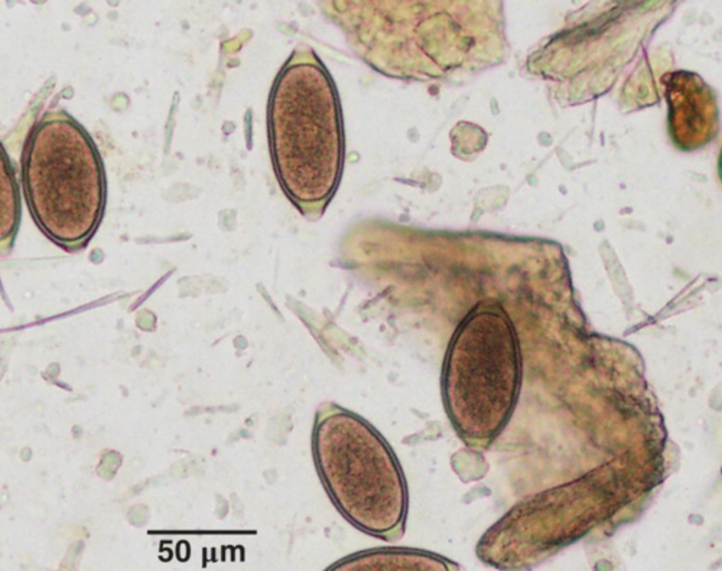 <p>What parasite is this if it is from a cat</p>