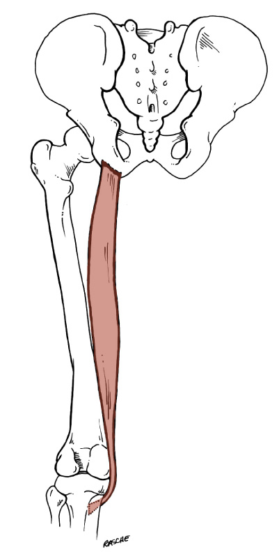 <p>Origin: <span>Lower, medial surface of ischial tuberosity (common tendon with biceps femoris m.)</span></p><p>Insertion: <span>Medial surface of Tibia (via pes anserinus)</span></p><p>Action: <span>extends the thigh, flexes the leg</span></p>