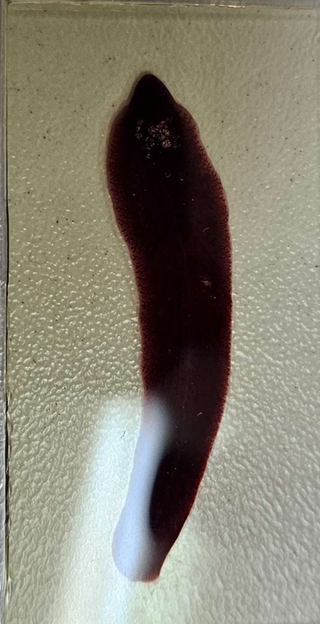 <p><span data-name="microscope" data-type="emoji">🔬</span><span data-name="petri_dish" data-type="emoji">🧫</span><strong><span> </span>Na podstawie zdjęcia preparatu:</strong></p><p></p><ul><li><p><span data-name="book" data-type="emoji">📖</span><span> </span>rozpoznaj gatunek pasożyta;</p></li></ul><p></p><ul><li><p><span data-name="recycle" data-type="emoji">♻</span><span> </span>rozpoznaj wszystkie formy rozwojowe;</p></li></ul><p></p><ul><li><p><span data-name="microbe" data-type="emoji">🦠</span><span> </span>wskaż organelle i cechy charakterystyczne dla danego gatunku;</p></li></ul><p></p><ul><li><p><span data-name="mask" data-type="emoji">😷</span><span> </span>nazwij chorobę, którą pasożyt wywołuje.</p></li></ul><p></p>