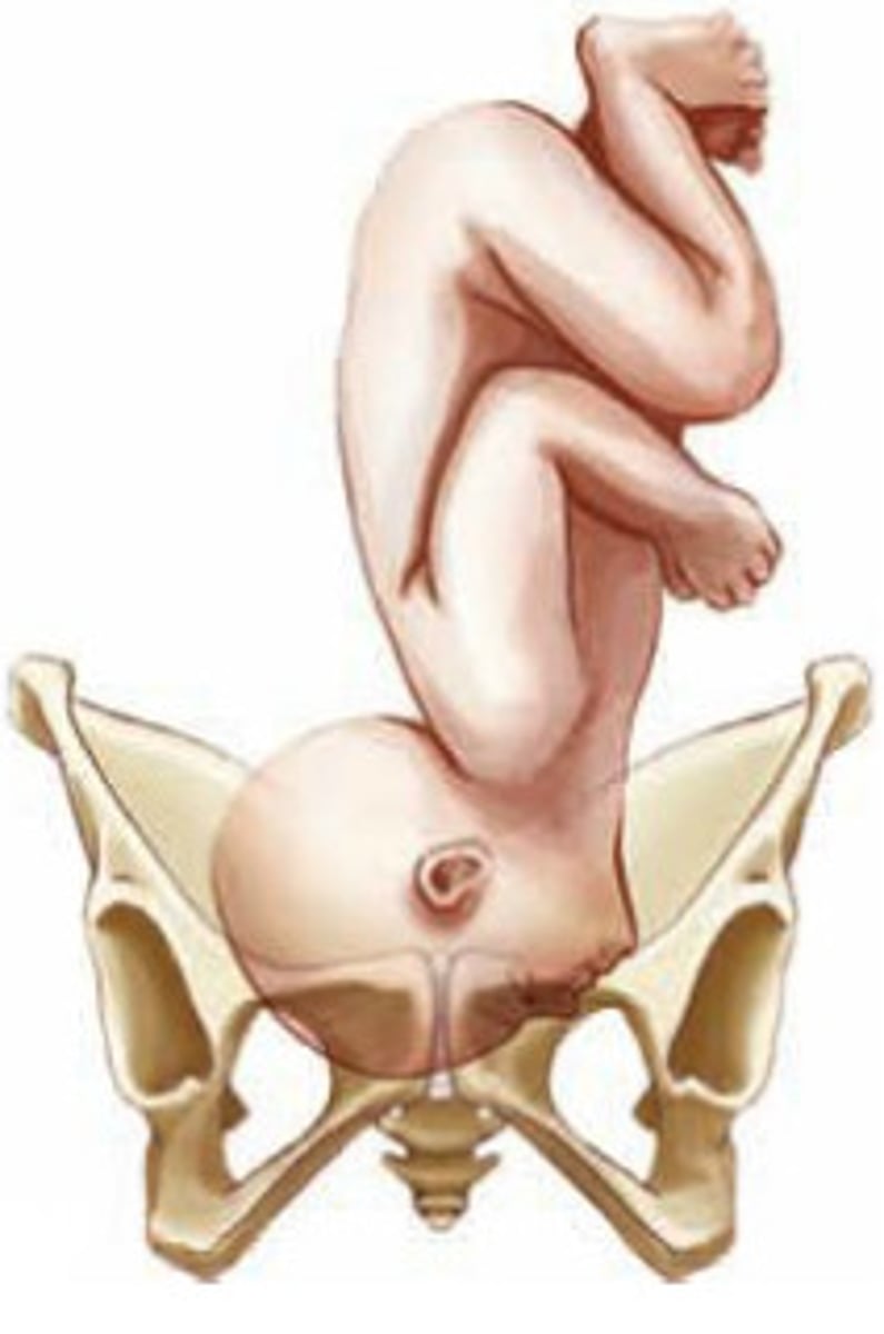 <p>chin extended</p>