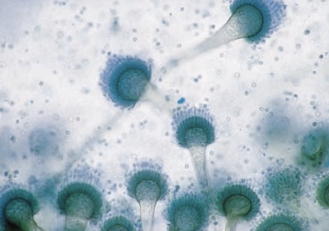 <p>Aspergillus Fumigatus</p>