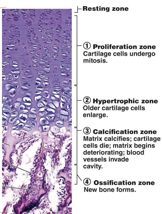 <p></p><ol><li><p><span style="background-color: transparent;">Resting zone - young chondrocytes</span></p></li><li><p><span style="background-color: transparent;">Proliferation zone - young chondrocytes undergo mitosis</span></p></li><li><p><span style="background-color: transparent;">Hypertrophic zone - old chondrocytes enlarge</span></p></li><li><p><span style="background-color: transparent;">Calcification zone - old chondrocytes calcify, matrix hollows, blood vessels vascularise bone</span></p></li><li><p><span style="background-color: transparent;">Ossification zone - New bone forms</span></p></li></ol><p></p><p>Within adults, the growth plate ossifies to become an <strong><u>epiphyseal line.</u></strong></p>