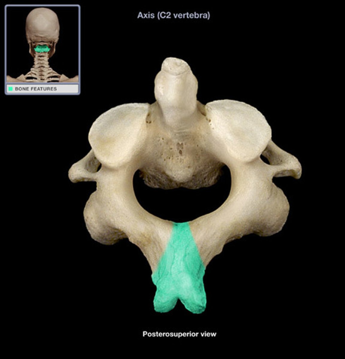 <p>origin of rectus capitis posterior major</p>
