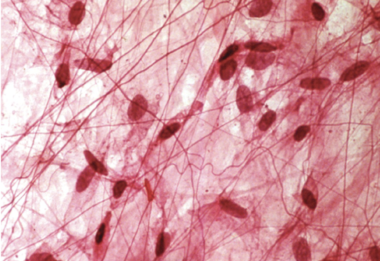 <p>Areolar Tissue</p>