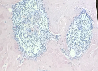 <p>Diagnostico</p>