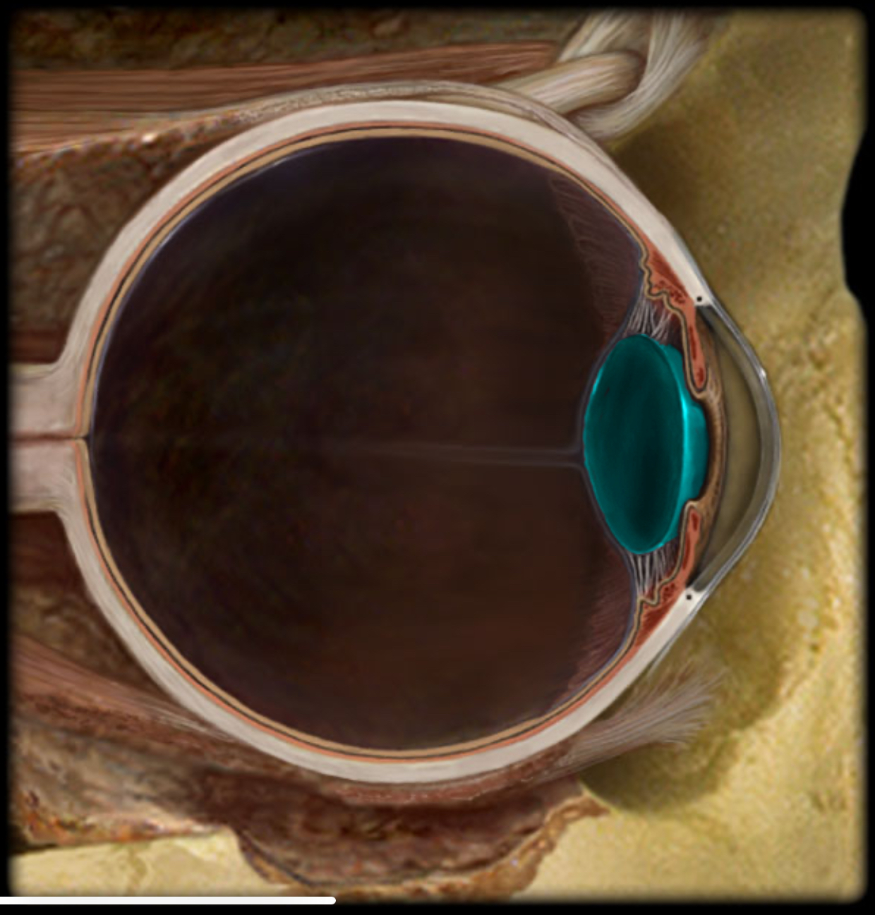 <h4 collapsed="false" seolevelmigrated="true"><strong>Location:</strong></h4><ul><li><p>Eye (posterior to iris)</p></li></ul><h4 collapsed="false" seolevelmigrated="true"><strong>Description:</strong></h4><ul><li><p>Biconvex lens</p></li><li><p>Composed of cells called lens fibers</p></li></ul><h4 collapsed="false" seolevelmigrated="true"><strong>Function:</strong></h4><ul><li><p>Light refraction</p></li><li><p>Focuses light onto neural retina</p></li></ul>