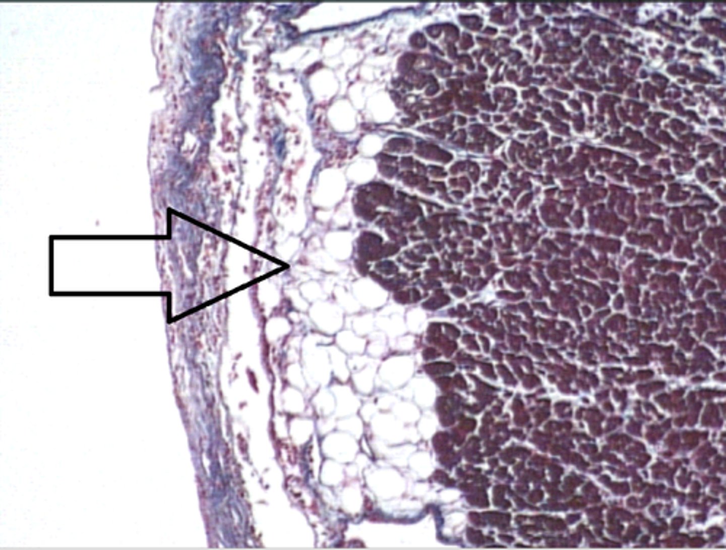 <p>Identify the cells at the arrow?</p>