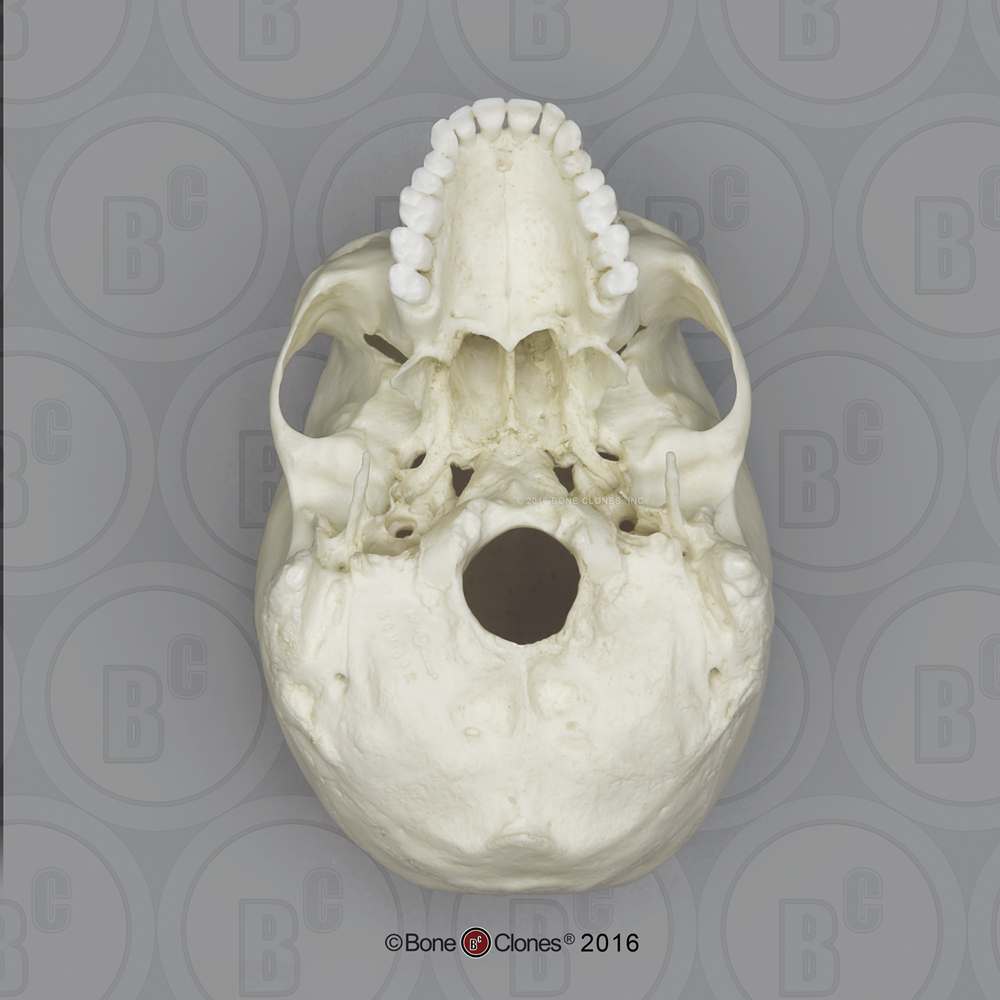 <p>Styloid Process</p>